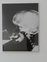 X-ray of person drinking